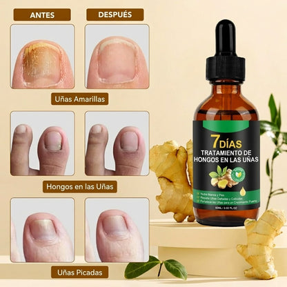 Serúm para el hongo en las uñas | 7 Days®