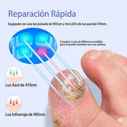 Láser para reparación de uñas | NailClear™